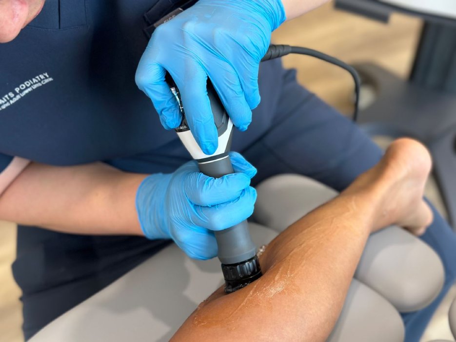 Radial pressure wave therapy