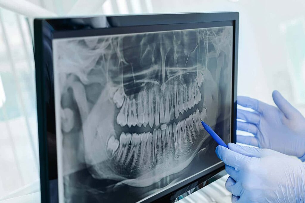 Affordable dental implants las vegas