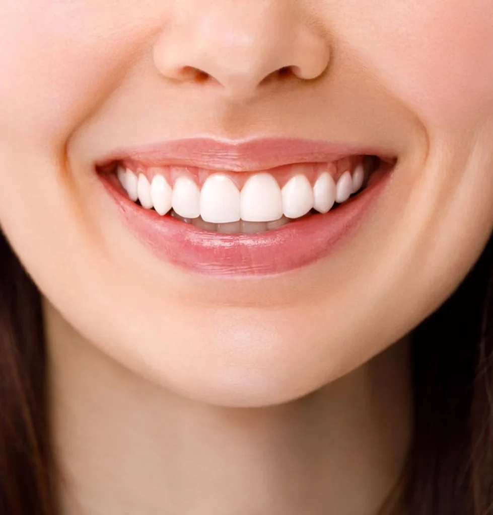 Tooth colored img